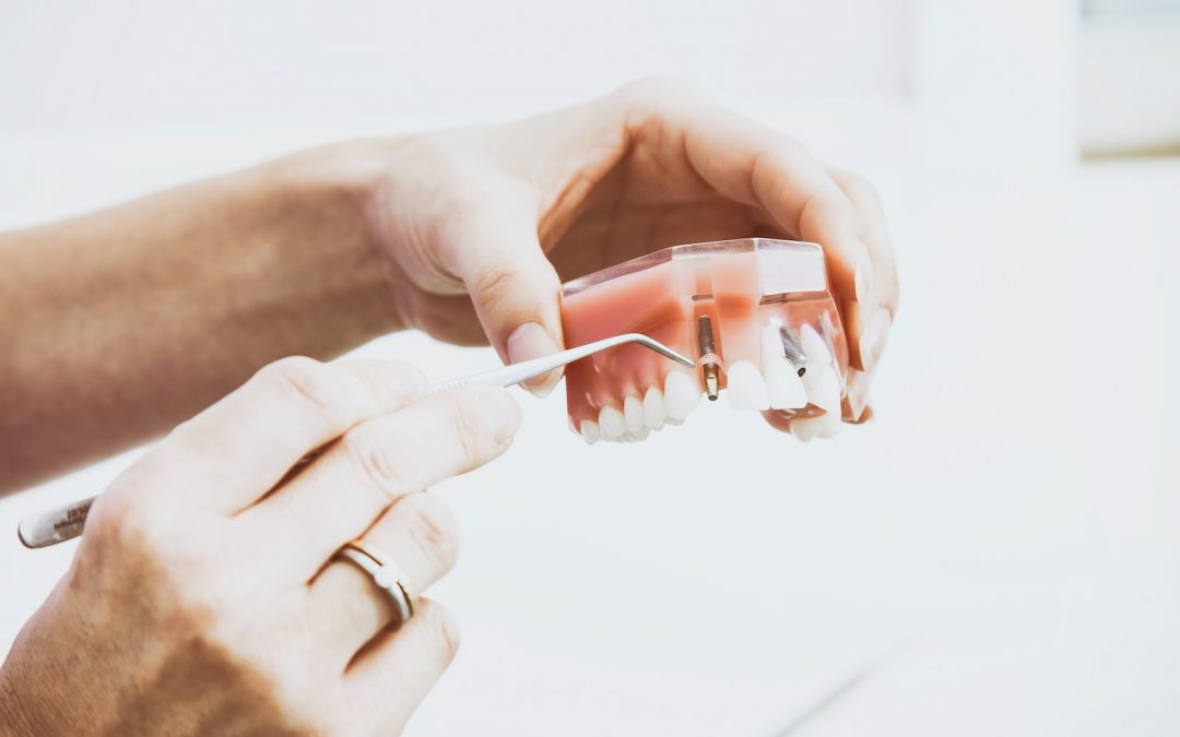 How Intraoral Scanners are Revolutionising Restorative Dentistry
