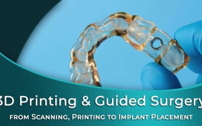 3D Printing & Guided Implant Surgery: Everything You Need to Know from Scanning, Printing to Implant Placement