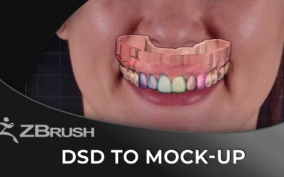 3D Smile Design using Smilecloud and ZBrush Software