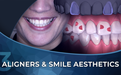 An Interdisciplinary Approach to Clear Aligners