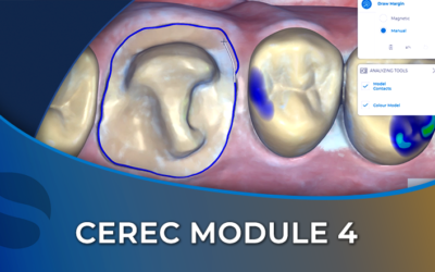 CEREC 04 Model Phase