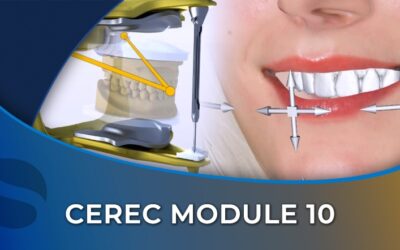 CEREC 10 Additional Functions – Surgical Guide, Smile Design, and Virtual Articulator