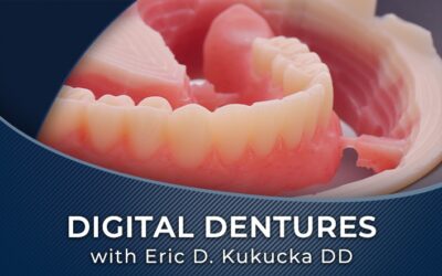 Digital Dentures – Clinical Workflow Overview