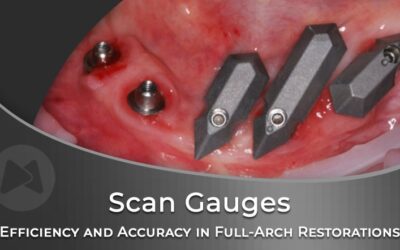 Efficiency and Accuracy in Full-Arch Implant Restorations from Planning to Delivery