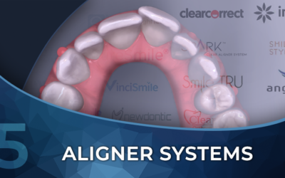 How to Choose an Aligner System
