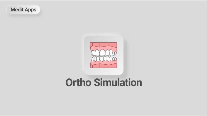 Medit Ortho Simulation: How it Enhances Orthodontic Treatment Planning
