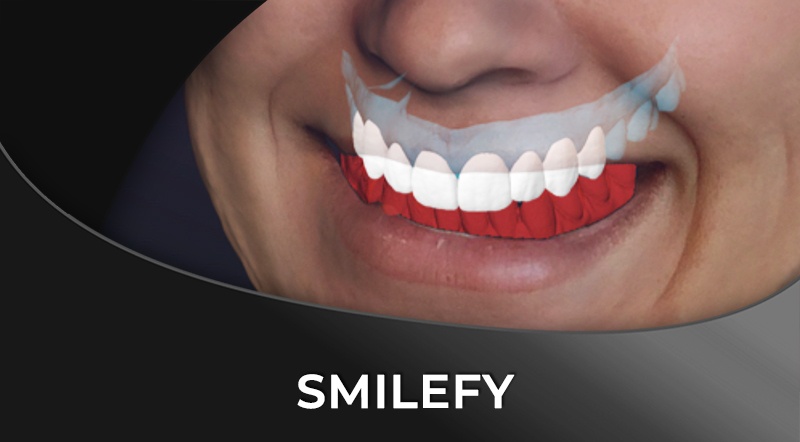 SmileFy – the Newest 3D Digital Smile Design Software